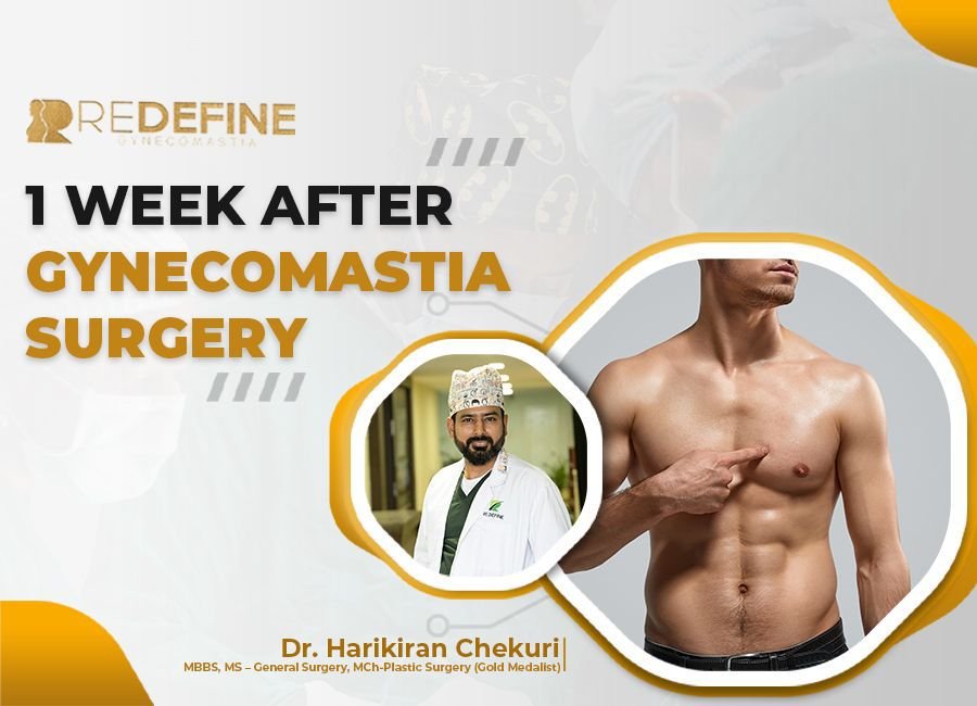 1 week after gynecomastia