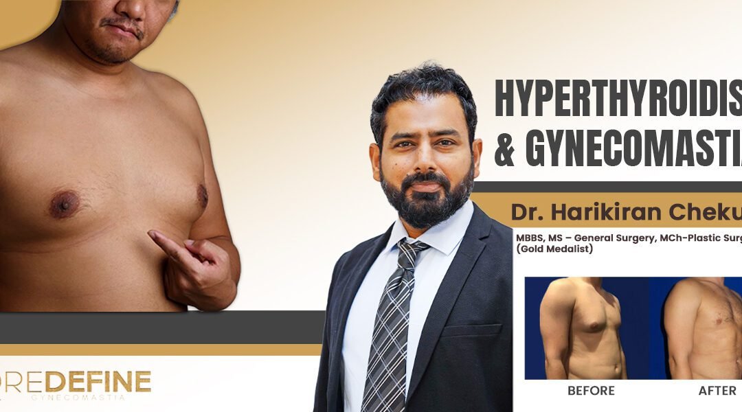 hyperthyroidism & gynecomastia