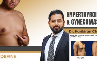 Hyperthyroidism and Gynecomastia – What is the link?