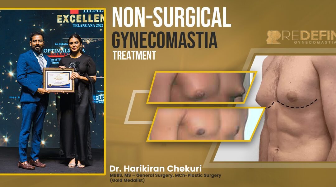 non surgical gynecomastia