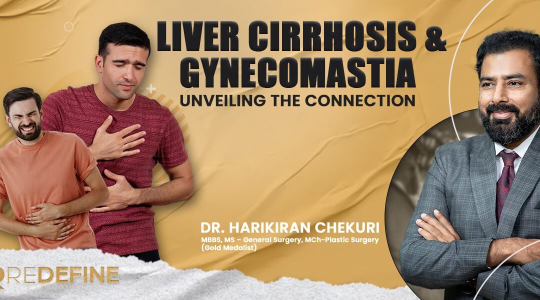 Liver Cirrhosis and Gynecomastia