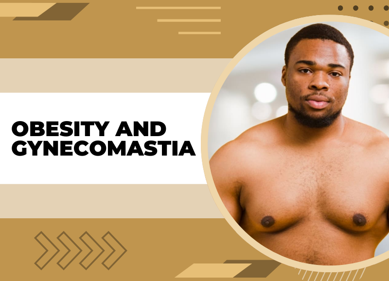 Obesity And Gynecomastia