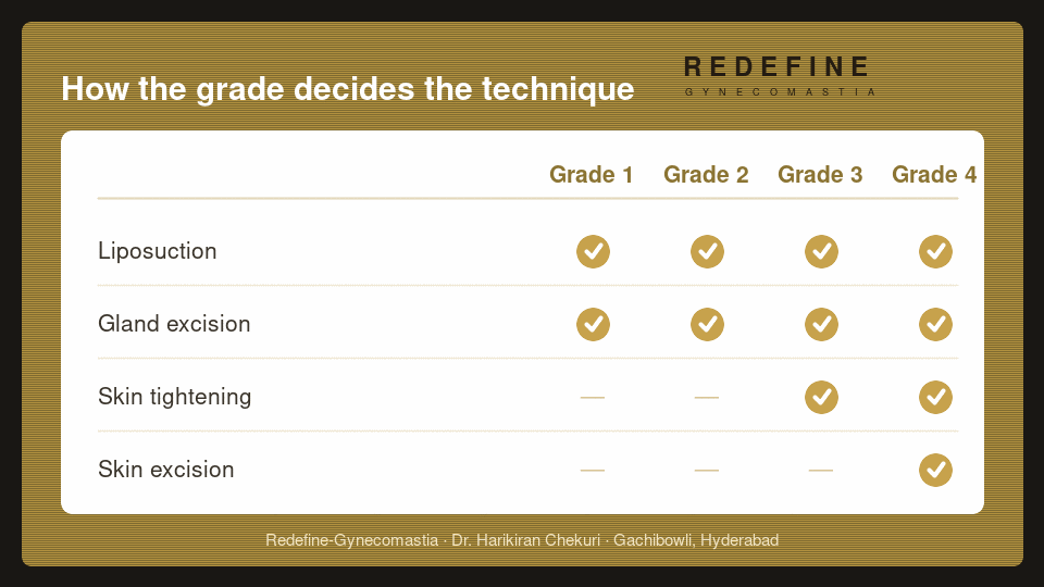 Gynecomastia grades and treatment options — Redefine, Hyderabad