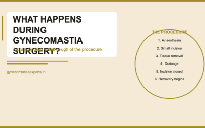What Happens During Gynecomastia Surgery? A Plain-English Walkthrough